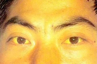 我才33岁就患了肝癌为什么肝癌会找上我长沙记者临终感悟