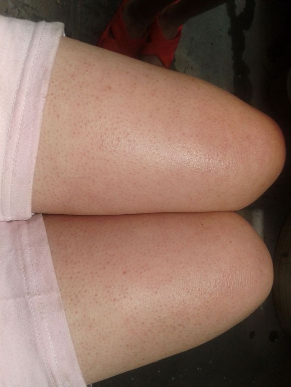 感觉鸡皮肤比以前多了(感觉鸡皮肤比以前多了怎么回事) 感觉鸡皮肤比以前多了(感觉鸡皮肤比以前多了怎么回事)