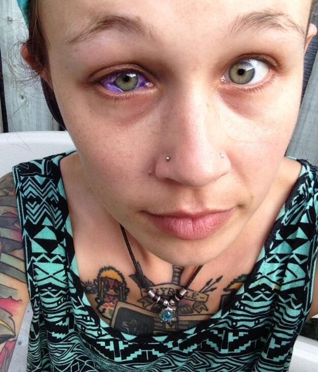 美女模特眼睛突然不时流出紫色眼泪得知真相后却让人傻眼了