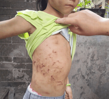 小女孩爸爸长期外出打工妈妈找了个男人小女孩经常挨打