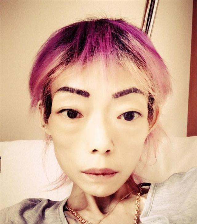 22岁嫁入豪门惹人羡,今病得只剩44斤,丈夫娶新欢她四处求医活命