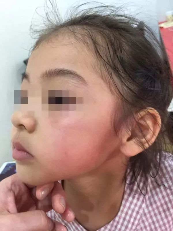 宁波4岁女孩被对方家长凶狠掌掴!视频不忍再看第二遍