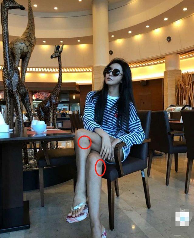 43岁变性人河莉秀晒照,嘟嘴卖萌似18岁,然而腿上淤痕却吓人