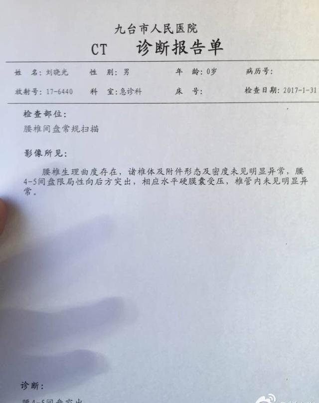 刘小光回应腰间盘突出 绯闻已经过去 微博给赵四留言已经收到