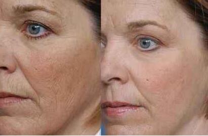 女性注意:它会引起皮肤暗黄,也是衰老的元凶,要引起警惕|抗氧化|皮肤