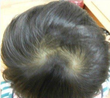 二旋楞, 三旋是个暴脾气, 你的孩子头上有几个旋呢|暴脾气|头发|脾气