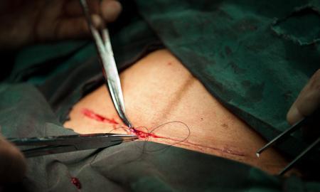 生完孩子30天,每天家务从早干到晚,医生说的话让老公大哭!