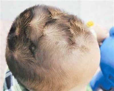 一旋精二旋楞三旋是个暴脾气你的孩子头上有几个旋呢