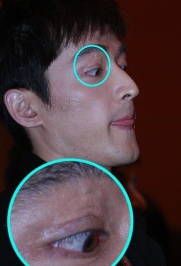 曾遭遇事故险些毁容的明星,胡歌,鹿晗福大命大,最惨的是他俩!