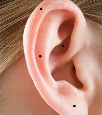 这几处有2个痣以上的人,财产不可限量,必是富贵之人!