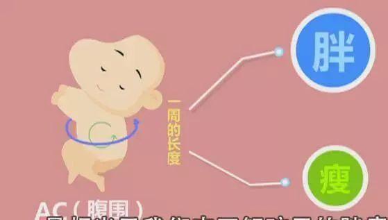 第二个胎儿的头围双顶径实际上就是胎儿两个顶骨之间的距离,我们可以