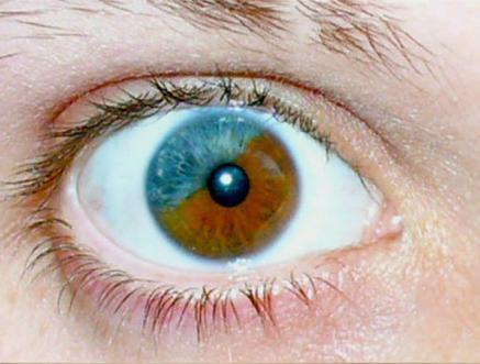 黄种人的眼睛什么颜色图片