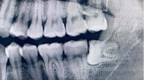 绝望游戏的主角是谁 绝望游戏的凶手是谁