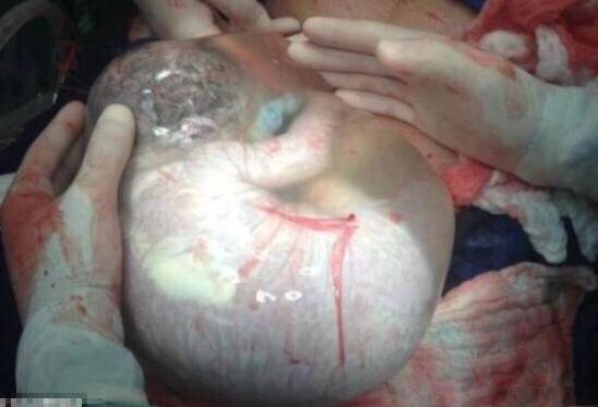 吮吮手指解解闷 宝宝长到32周左右,就可能出现吮手指的动作,这是宝宝