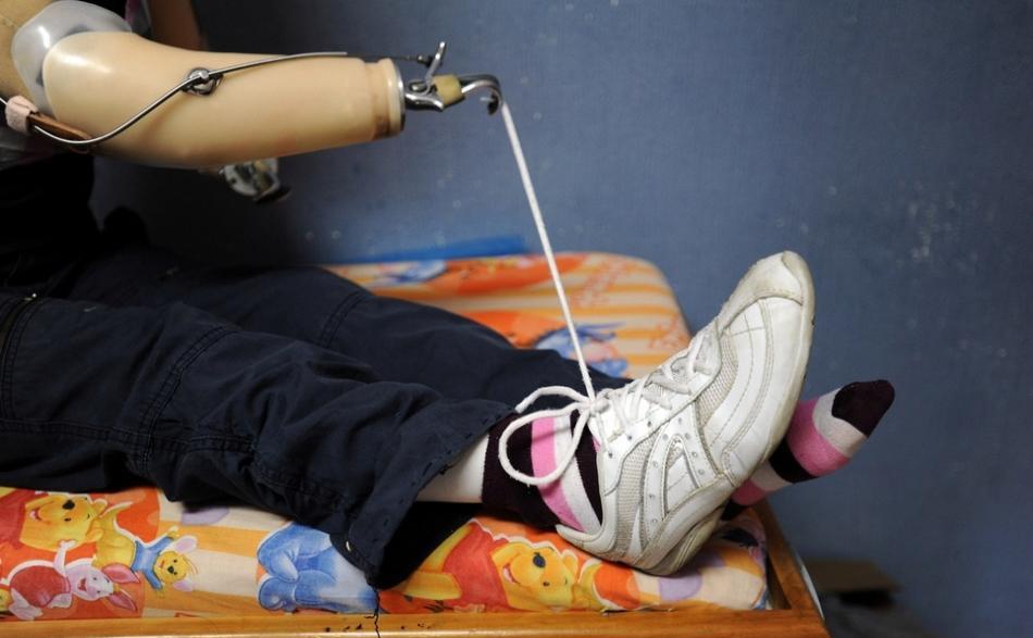 因触电失去了双手, 16岁女孩如今仍坚强地用口咬着笔写字,画画