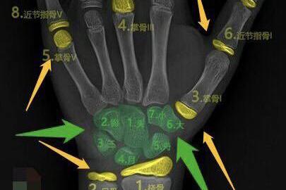 深圳恒生医院骨龄测试价格 基层儿保科如何快速高效完成骨龄评估