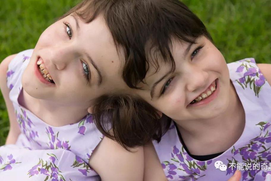 老婆怀双胞胎我该怎么办 双胞胎怀孕有哪些注意事项