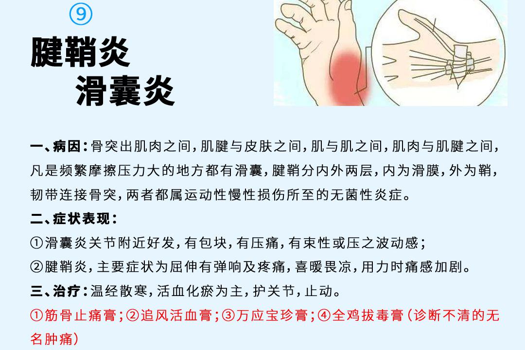 腱鞘炎、滑囊炎你了解多少?_新浪新闻