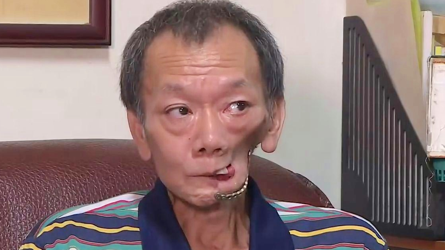 槟榔危害有多大 农村大叔嚼槟榔13年 如今连水都喝不下了