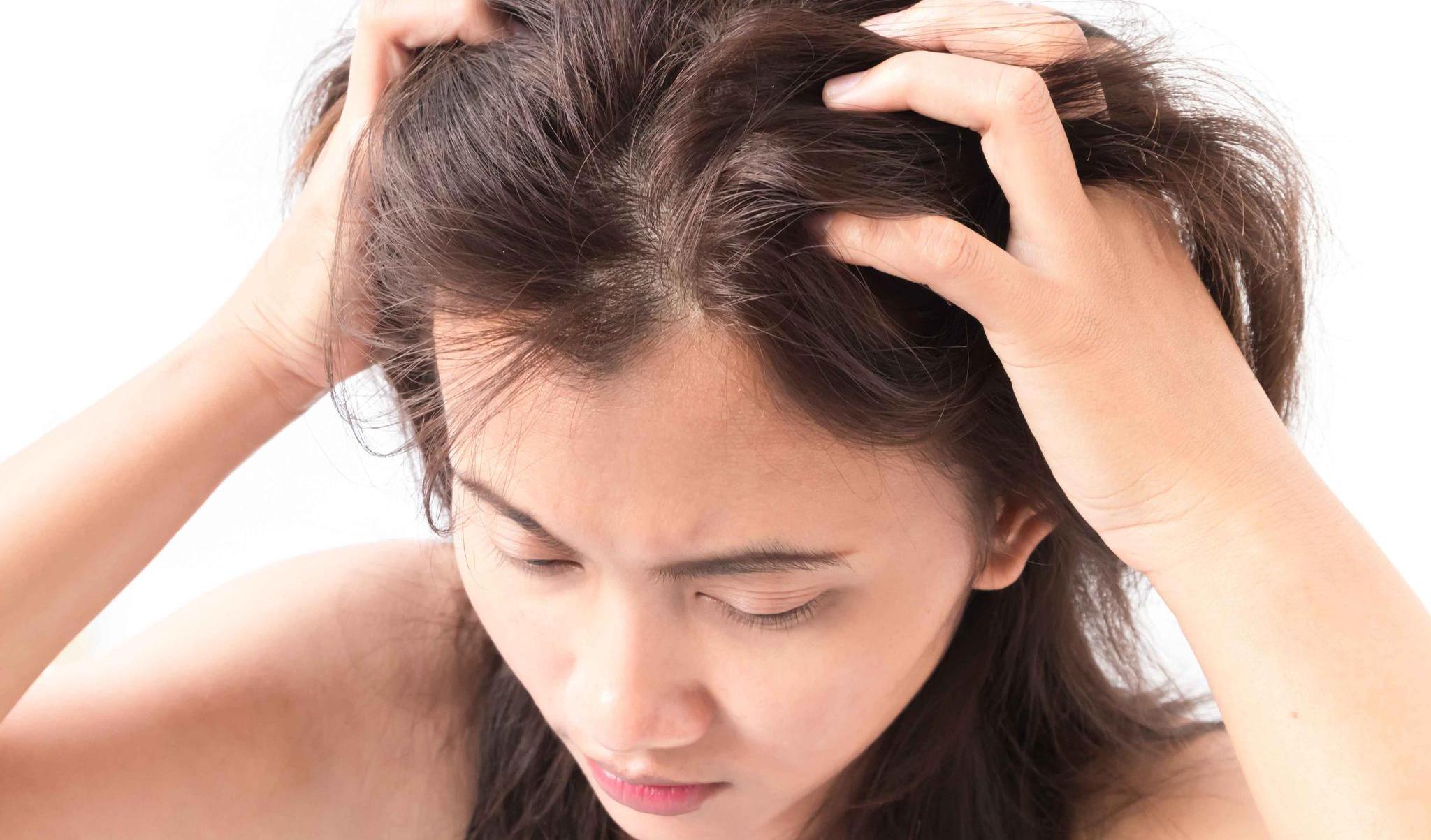 去头屑的洗发水最好用的是哪三款 广东四会市兴富生物科技有限公司生产哪种洗发露