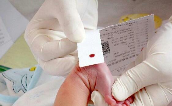 比如先天性甲状腺功能减低,比如苯丙酮尿症,有先天性肾上腺素皮质增生