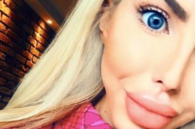 女子花费30万整容成"芭比娃娃",越整越丑,变成香肠嘴