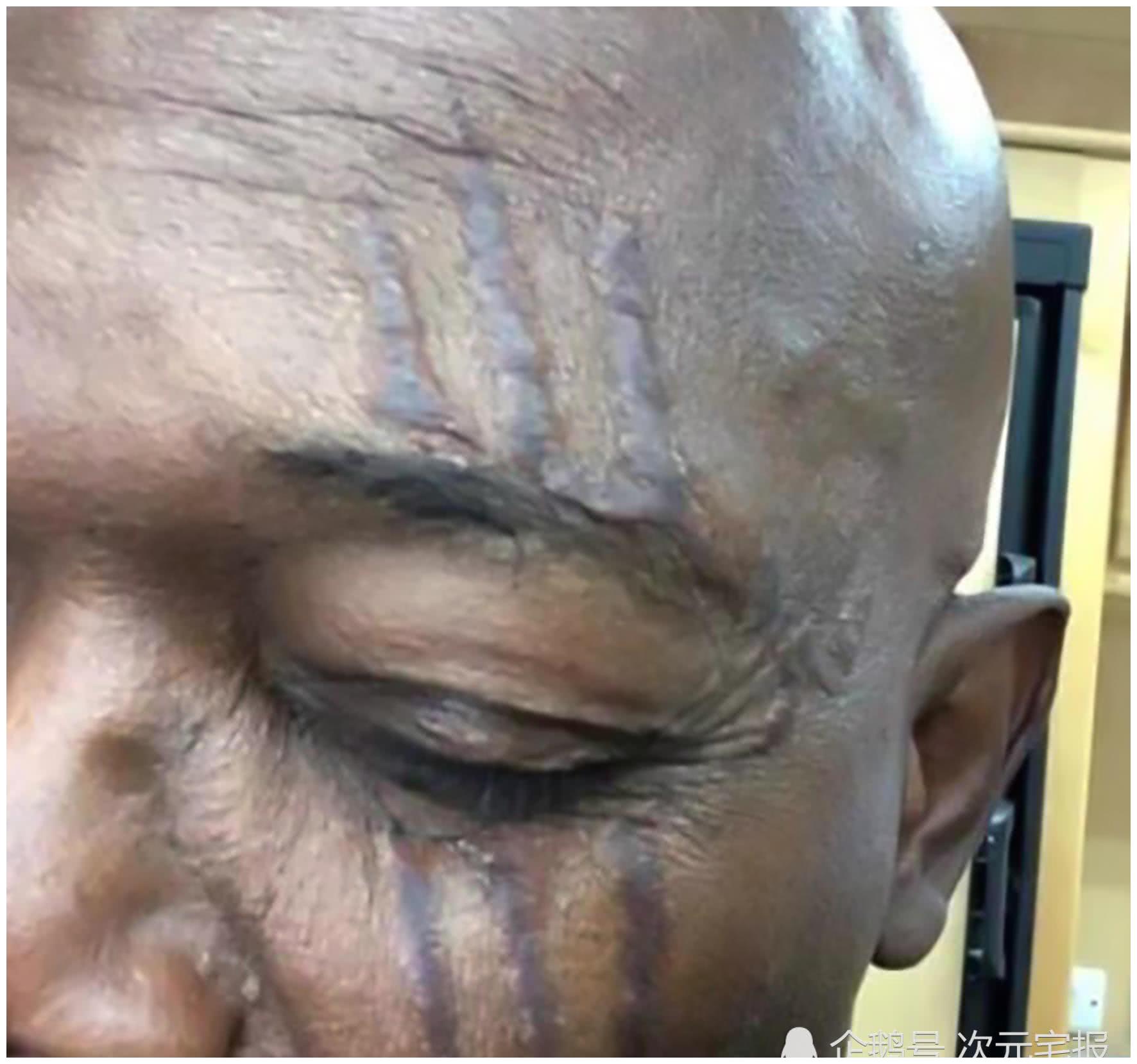 对于他这一只眼睛究竟是被谁所伤,很多人都猜测应该是由斯库鲁人造成