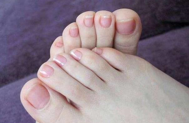 脚指头脚趾甲出现这些现象可能是给你的癌症信号