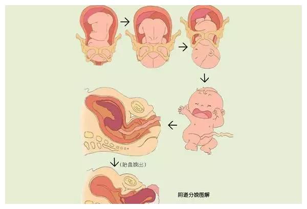长,有人时间短,四个因素直接影响分娩时间|分娩|骨盆|宫缩_新浪新闻
