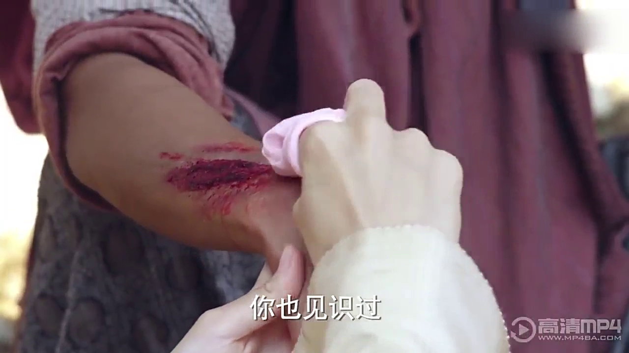 阿sa冲浪不慎跌伤额头2厘米伤口表情痛苦惹人心疼