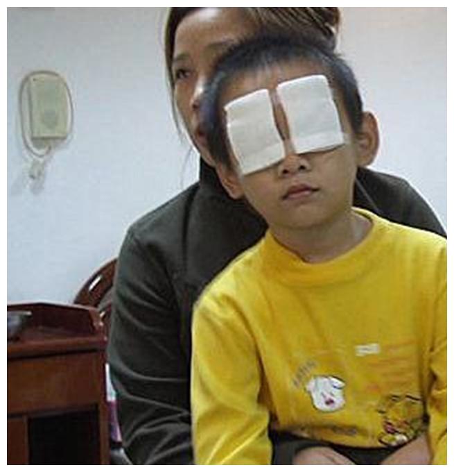 3岁儿子把石灰干燥剂撒进眼睛妈妈不敢用水冲洗差点害了孩子