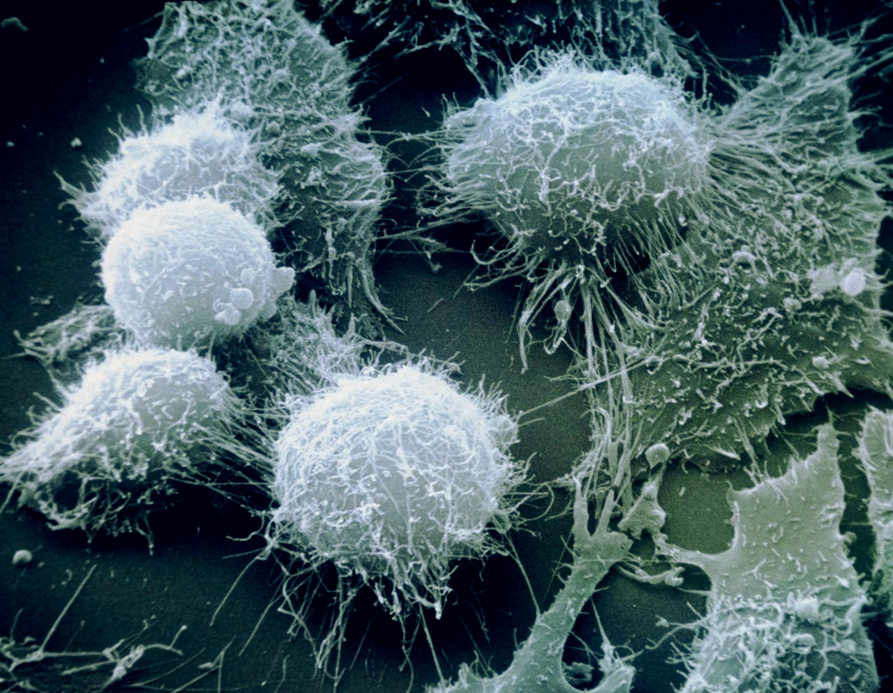 永生不死的海拉细胞,一种超越了衰老和死亡的存在物