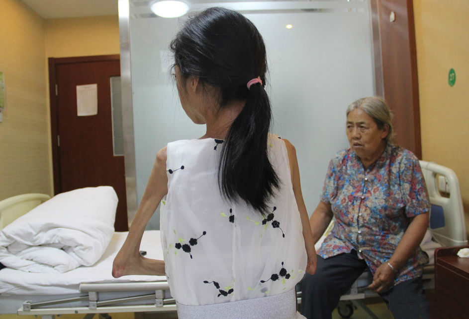 90后女孩患"渐冻症",6年未见父母面,奶奶为孙女看病不放弃