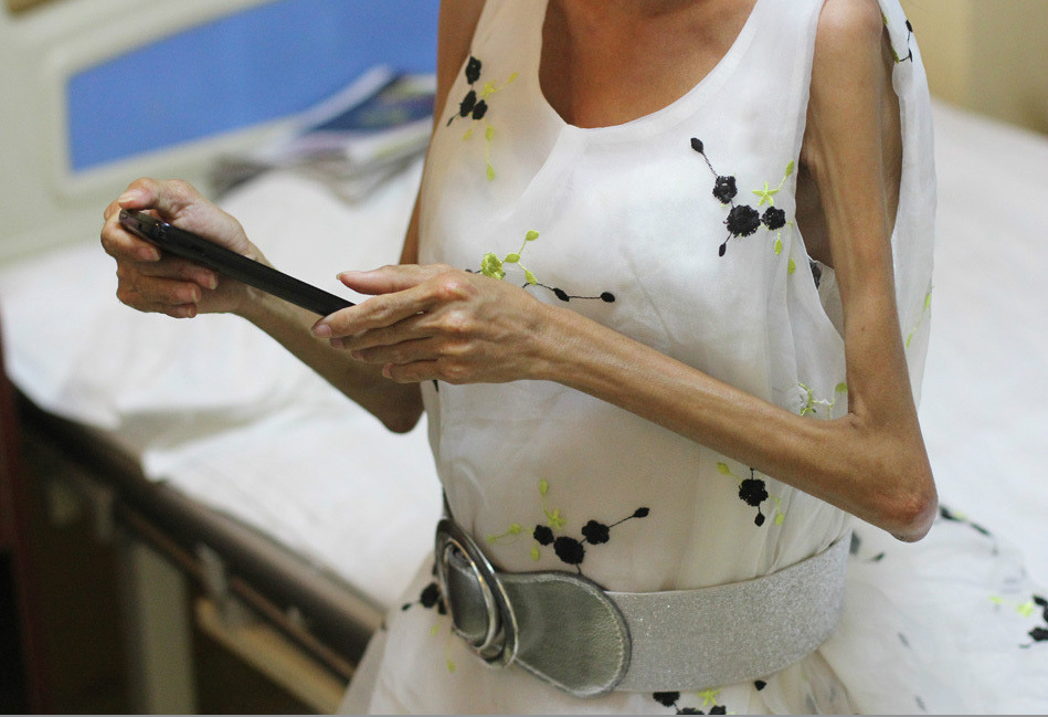 90后女孩患"渐冻症",6年未见父母面,奶奶为孙女看病不放弃|渐冻症|90