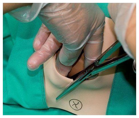 生孩子|分娩|胎盘_新浪新闻