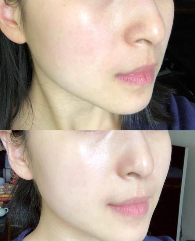 美即的镇店之宝奶皮面膜美白祛斑仿佛把脸泡在牛奶里