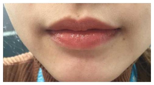 口大容拳位至公侯口垂两角衣食消缩口型看命运