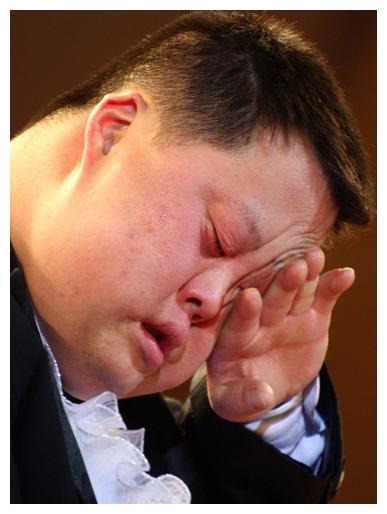"脑瘫天才指挥家"舟舟,风光不再,心智依旧是个孩子