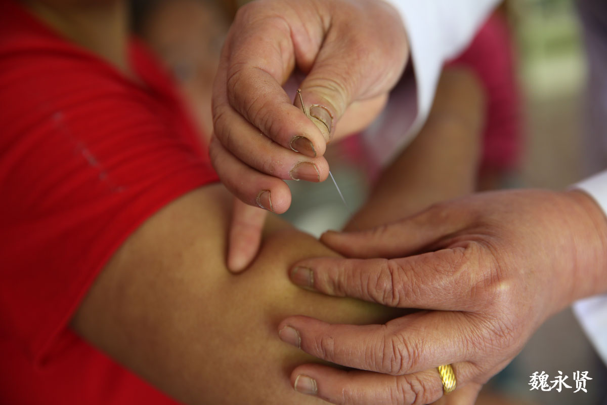 大山里的乡村医生银针救命接生过108个孩子没收过一分钱