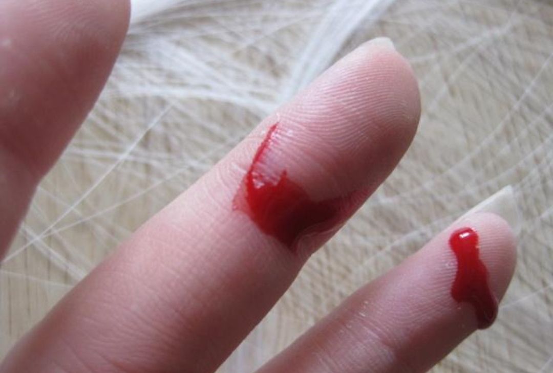手不小心受伤不怕,这个"调料"轻松止血,伤口愈合还快_高清图集_新浪网