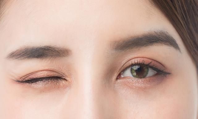 _脸上很多细纹怎么改善