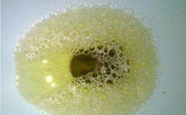 血糖高不高,看尿能知道尿液若有3种情况,许是糖尿病的原因