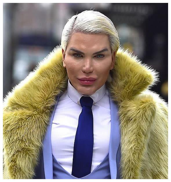 巴西整容狂人连头发都不放过,意外撞脸八两金?网友:钱都白花了