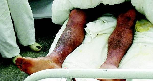 历史上臭名昭著的实验英国的芥子气实验简直泯灭人性