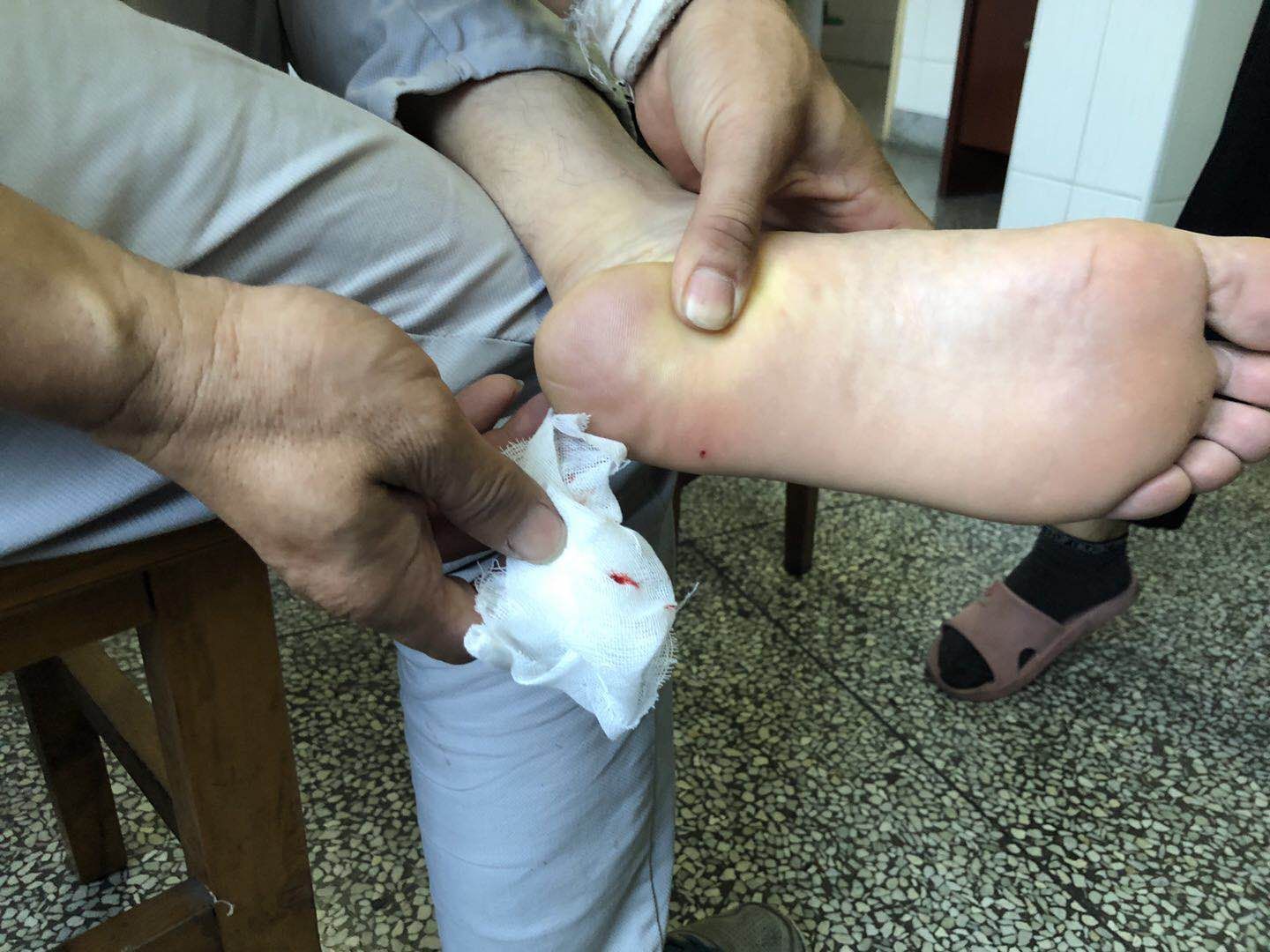 一男子脚底踩入2根针 惊动了5位消防出动一车赶赴现场处置