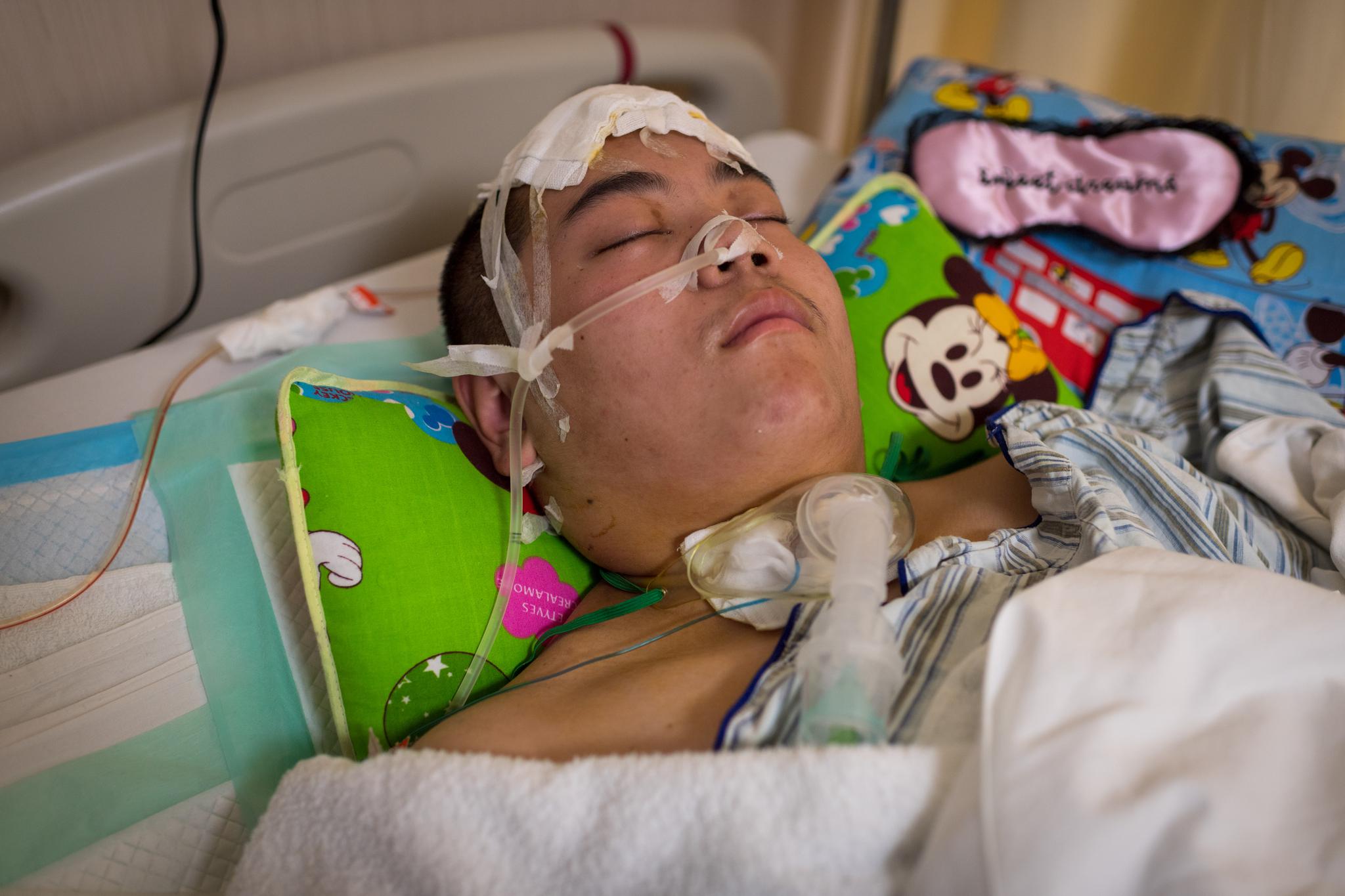 男孩课堂上突然晕倒,15天4次手术,昏迷20天还需开颅救命