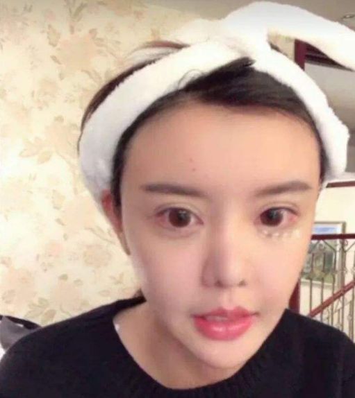 韩安冉整容后对自己的鼻子很满意看到前后对比图后钱没有白花