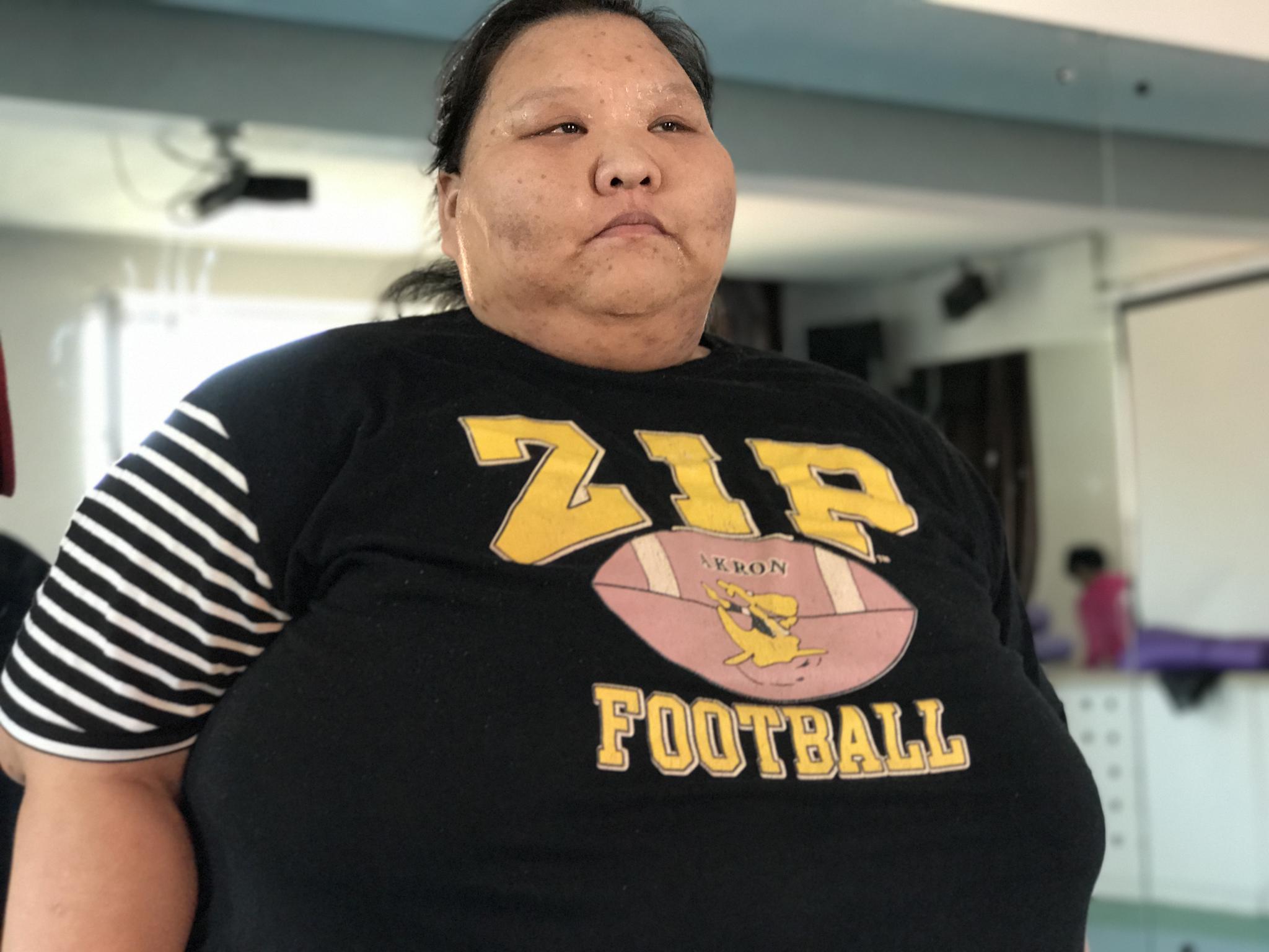 从前的她是一个不折不扣的大胖子,体重最高飙到400斤,把自家床压塌了