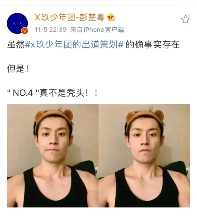 彭楚奥回应x玖少年团,但不是秃头
