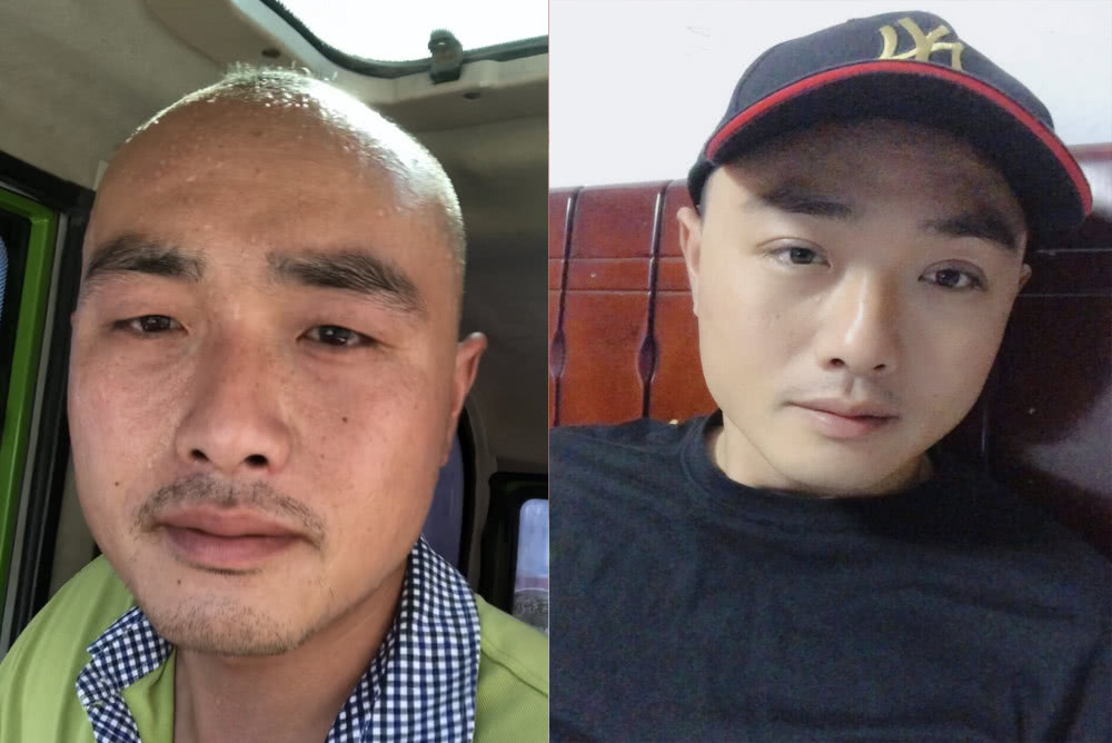 油腻大叔因秃顶长得丑求职屡被拒,今整容变帅后轻松应聘一次成功